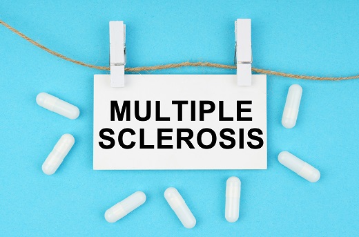 multiple-sclerosis-what-you-need-to-know